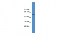 ARP59189_P050 - Alpha-2-antiplasmin / SERPINF2