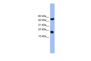 ARP59212_P050 - RWDD1