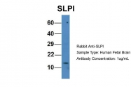 ARP59215_P050 - Antileukoproteinase / ALP