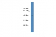 ARP59233_P050 - SERPINE1 / PAI1