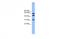 ARP59241_P050 - Kallistatin / SERPINA4