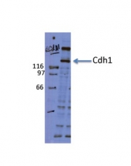 ARP59265_P050 - CD324 / Cadherin-1