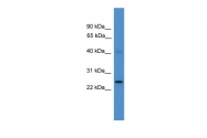 ARP59285_P050 - UCHL1 / PGP9.5