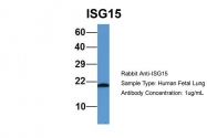 ARP59386_P050 - ISG15 / G1P2
