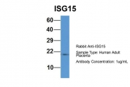 ARP59386_P050 - ISG15 / G1P2