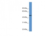 ARP59463_P050 - Neuronal pentraxin-1