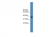 ARP59578_P050 - Barttin