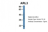 ARP59667_P050 - ARL3