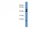 ARP59687_P050 - RERG