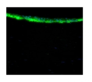 ARP59748_P050 - ALDH3