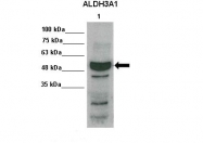 ARP59748_P050 - ALDH3
