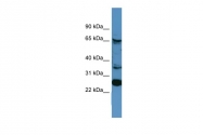 ARP59755_P050 - Calnexin