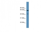 ARP59777_P050 - Rhodopsin kinase