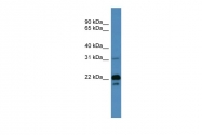 ARP59933_P050 - BASP1