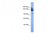 ARP59939_P050 - CD56