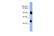 ARP59977_P050 - AP1 complex subunit beta-1 / AP1B1