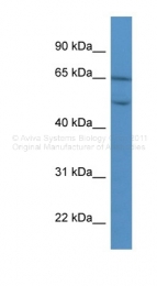 ARP60022_P050 - Collagen type VIII alpha 2 chain