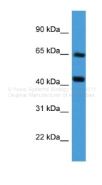 ARP60023_P050 - Collagen type VIII alpha 2 chain