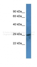 ARP60038_P050 - Coagulation factor VII (F7)