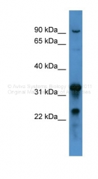 ARP60040_P050 - Coagulation factor VIII (F8)