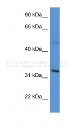ARP60097_P050 - Carbonic anhydrase 5A