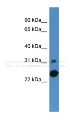 ARP60098_P050 - Carbonic anhydrase 7