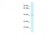 ARP60125_P050 - Cathepsin E