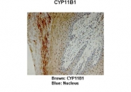 ARP60140_P050 - CYP11B1