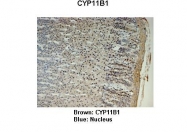 ARP60140_P050 - CYP11B1