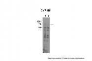 ARP60140_P050 - CYP11B1