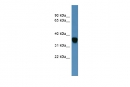 ARP60164_P050 - AKR1C1 / DHH1