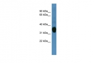ARP60165_P050 - AKR1C1 / DHH1