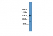ARP60281_P050 - Apolipoprotein(a) / LP(a)