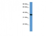 ARP60320_P050 - MAPKAP Kinase-2