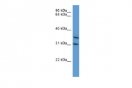 ARP60321_P050 - MAPKAP Kinase-3