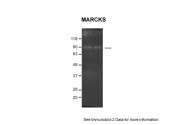 ARP60326_P050 - MARCKS