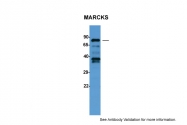 ARP60326_P050 - MARCKS