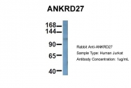 ARP60395_P050 - ANKRD27