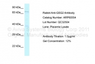 ARP60554_P050 - GSG2 / Haspin