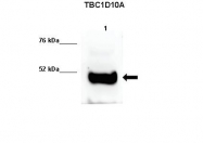 ARP60584_P050 - TBC1D10A