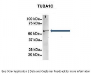 ARP60614_P050 - TUBA8 / TUBAL2