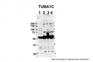 ARP60614_P050 - TUBA8 / TUBAL2