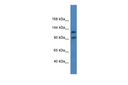 ARP60626_P050 - LONP2
