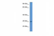 ARP60691_P050 - RAB2B