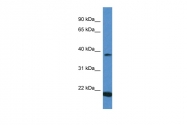 ARP60732_P050 - IFNA1 / Interferon-alpha 1