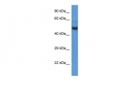 ARP60777_P050 - Neuron specific enolase