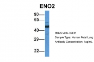 ARP60777_P050 - Neuron specific enolase