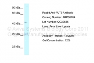 ARP60784_P050 - Fucosyltransferase 8