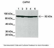 ARP60936_P050 - Calpain-1