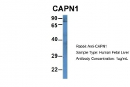 ARP60937_P050 - Calpain-1